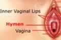 External Sexual Organ - Hymen