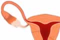 Internal Sexual Organ - Fallopian Tubes and Ovaries