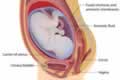 Uterus during Pregnancy